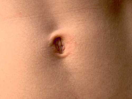 Sonhar com Umbigo: Sujo, Inflamado, Aberto, Machucado 5 umbigo