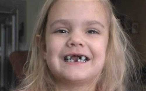 sonhos com dentes