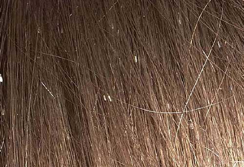 cabelo